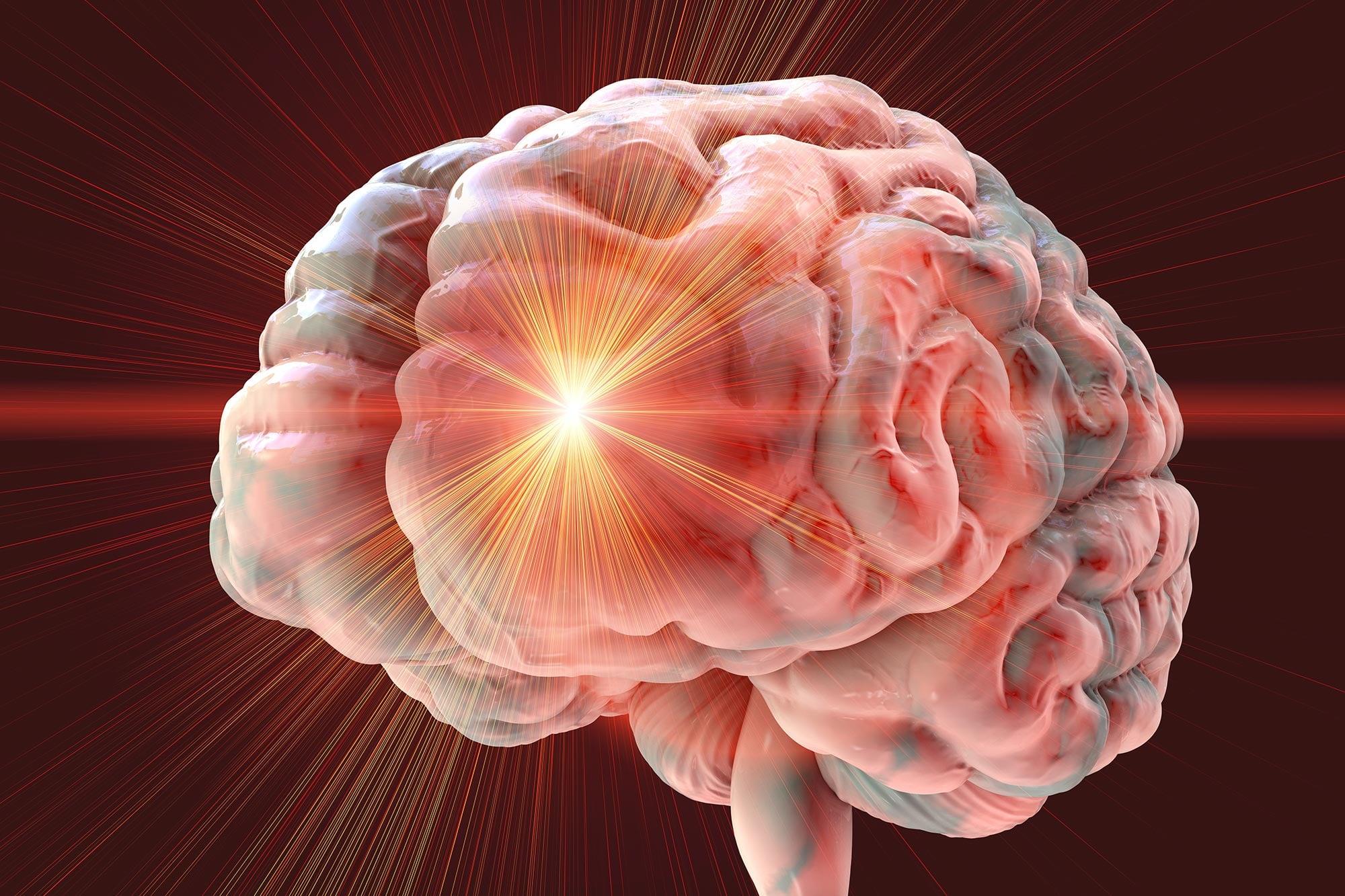 Scientists Reverse Stroke Damage Using Stem Cells in Breakthrough Study