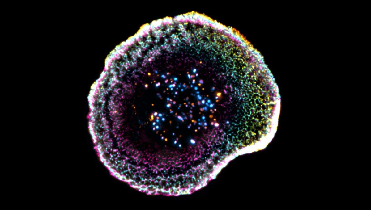 Scientists Just Captured Killer T Cells in Action Inside Tumors
