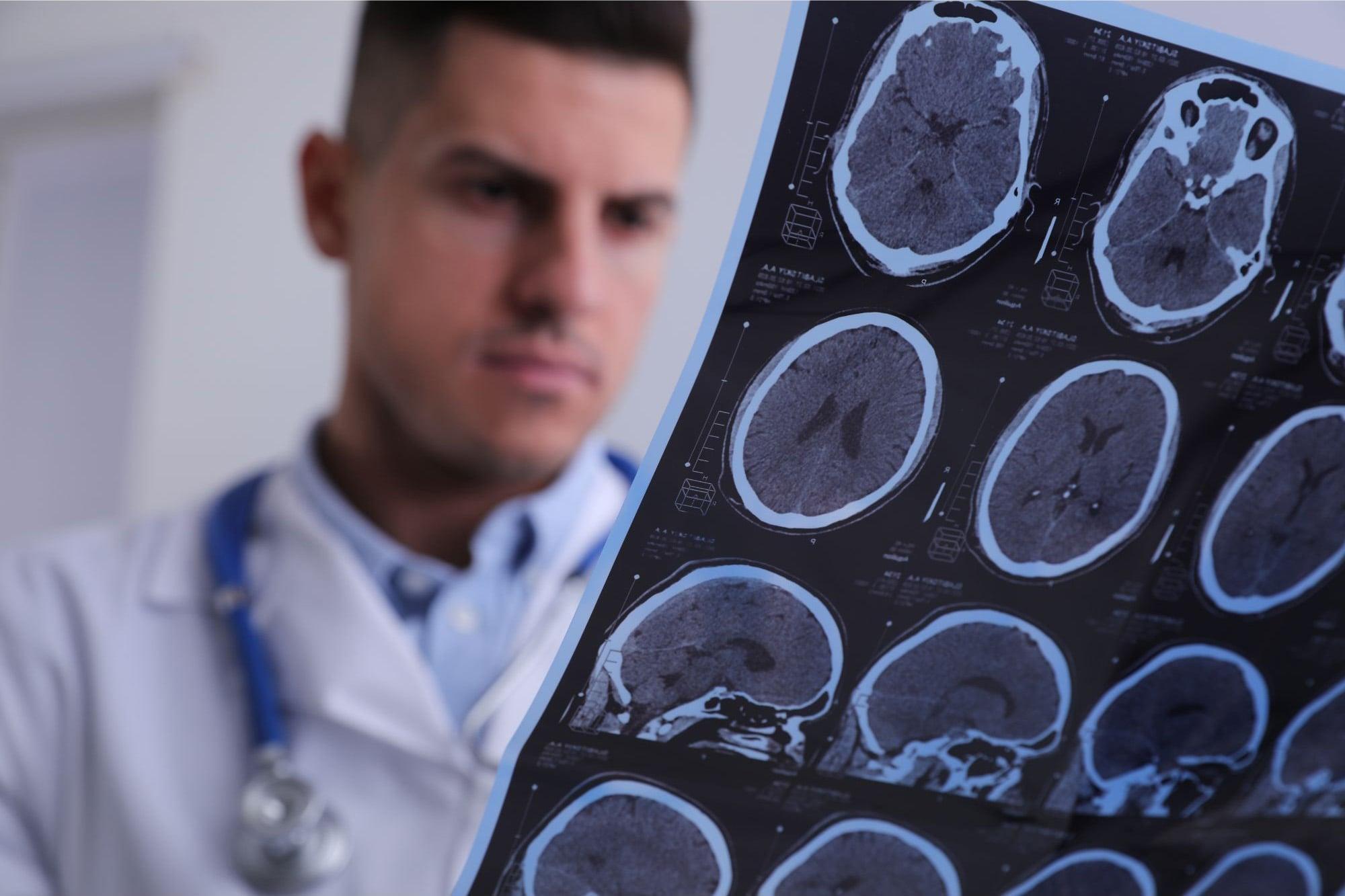 Scientists May Have Found a Way To Repair Nerve Damage in Multiple Sclerosis