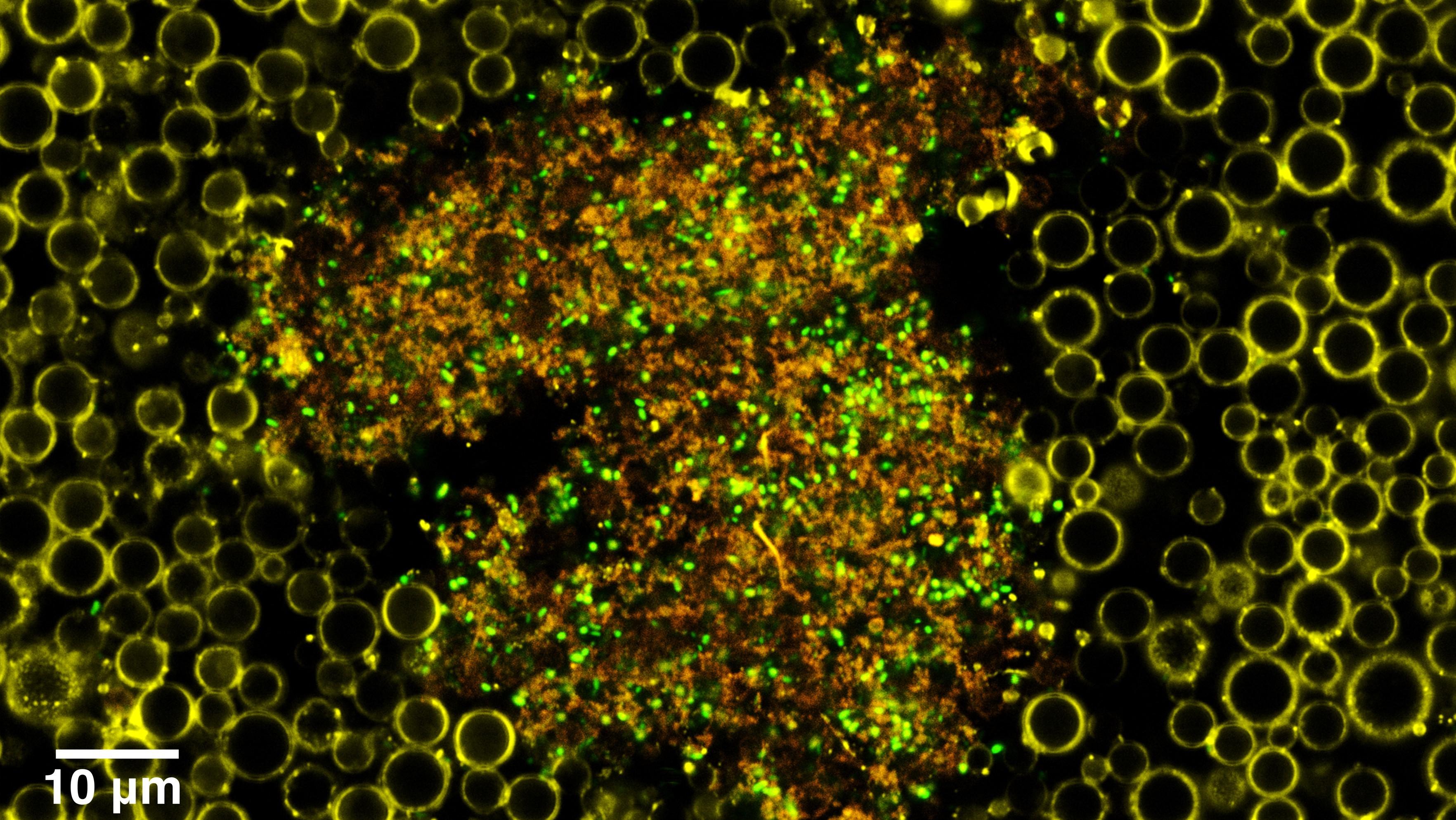 New ultrasound drug delivery system found to be highly effective against bacterial biofilms