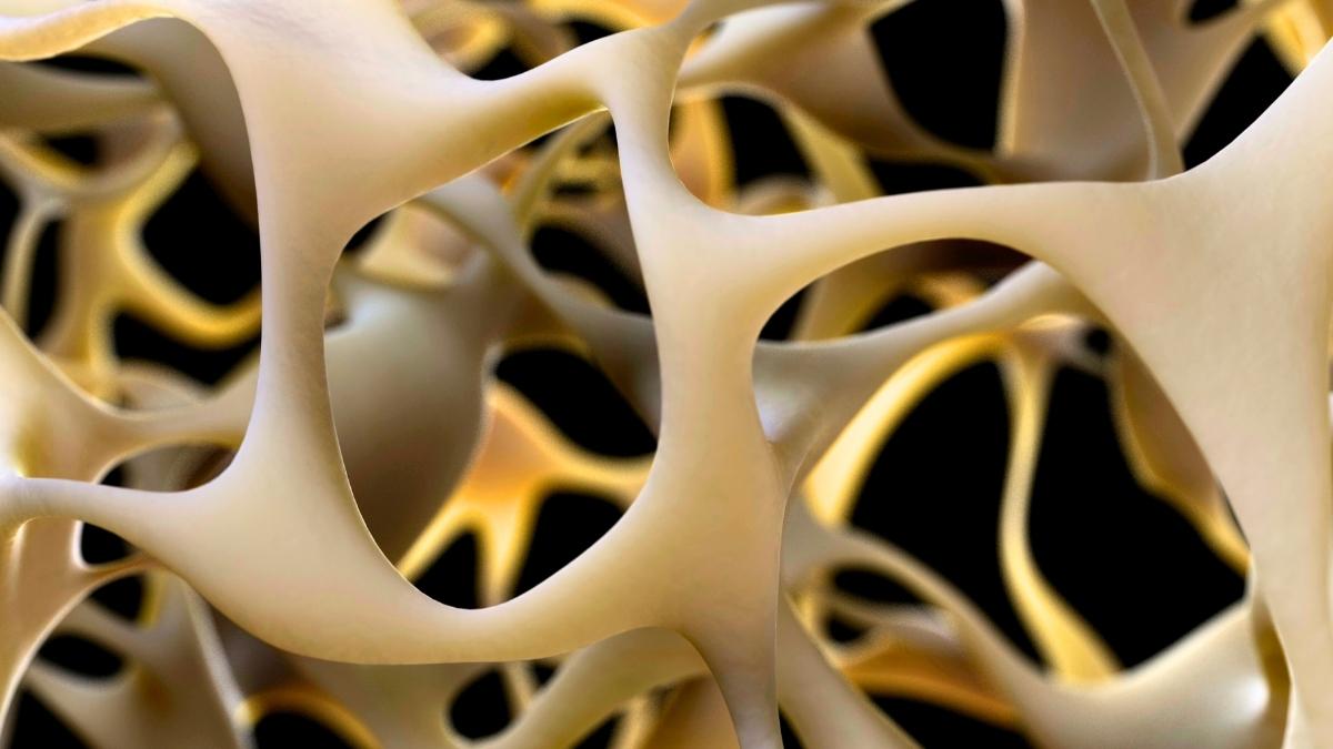 Breakthrough to Strengthen Bones Could Reverse Osteoporosis