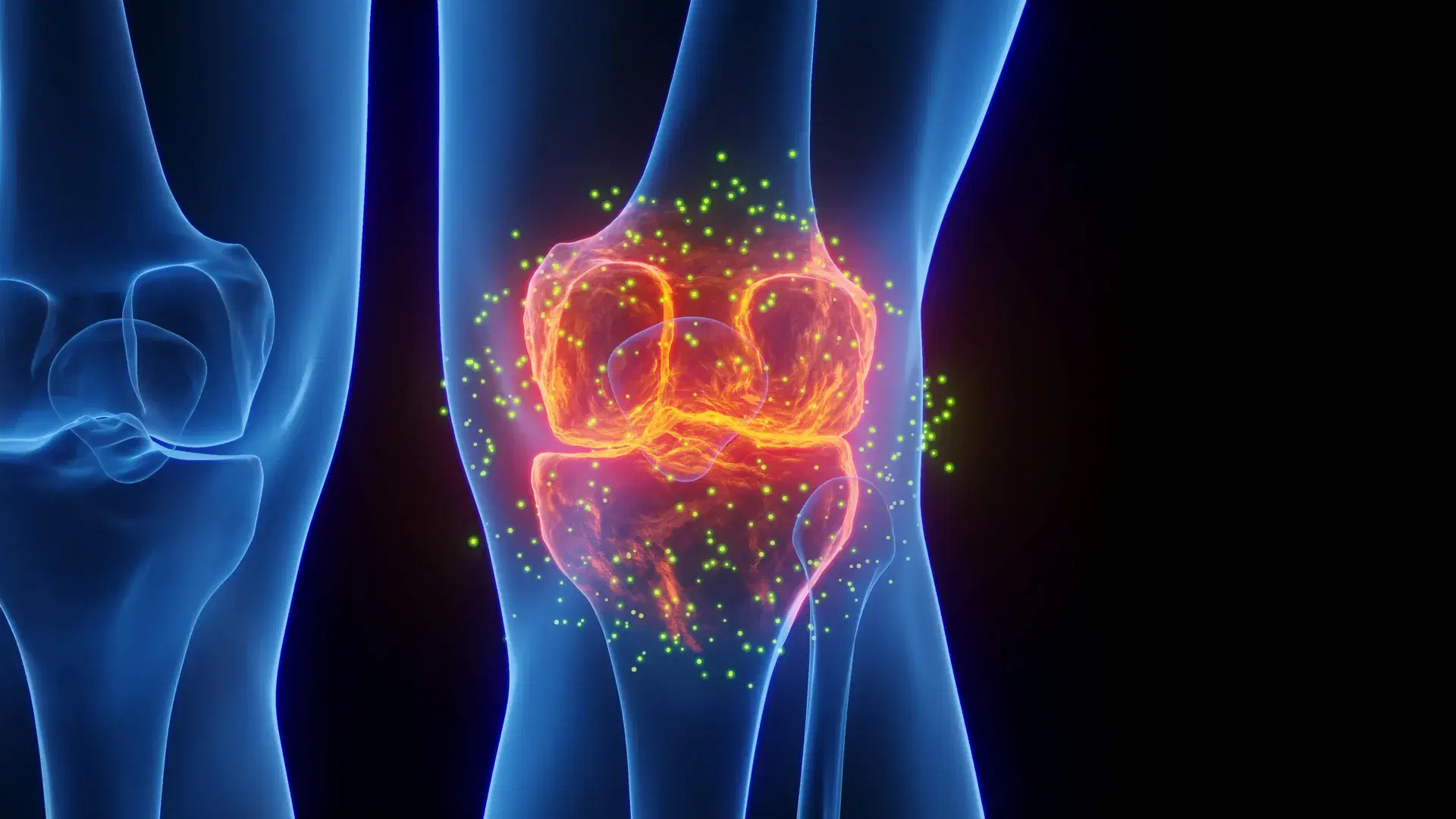 Stanford scientists regrow lost cartilage and reverse arthritis in major breakthrough