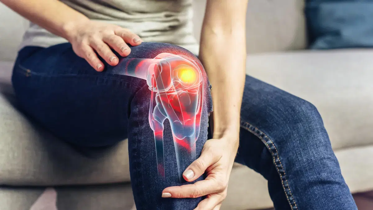 A new nonsurgical procedure helped 80% of knee arthritis patients achieve meaningful pain relief lasting at least a year, offering a new option before knee replacement surgery