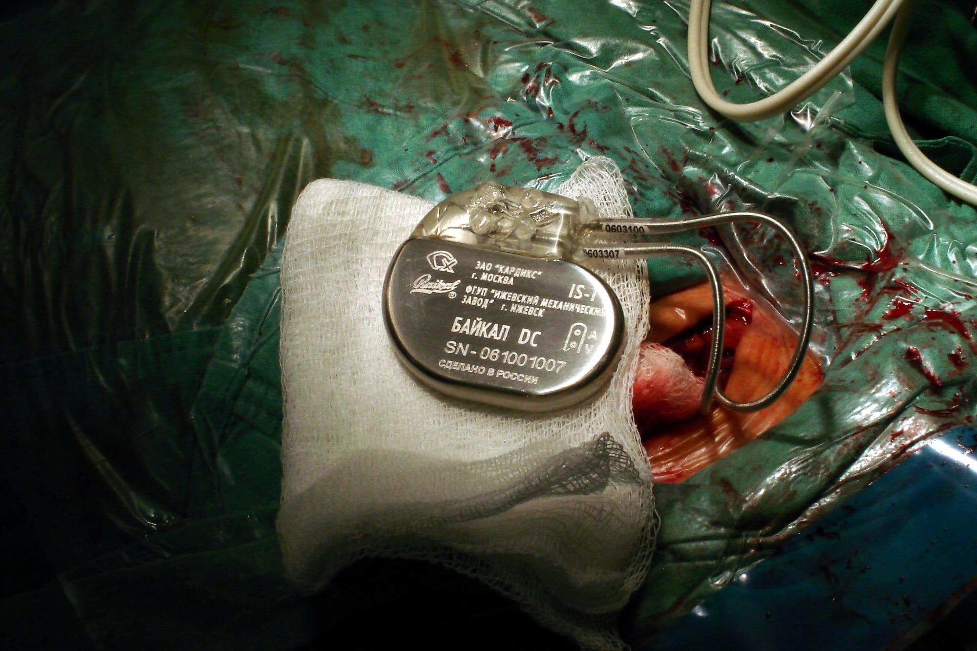 Engineers in South Korea developed a battery-free pacemaker powered by the beating of the heart that could, potentially, last a lifetime.