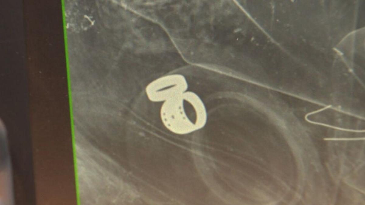 Hospital staff use X-ray, teamwork to recover patient’s lost heirloom rings that were accidentally thrown into trash bin | Using the portable machine, staff X-rayed bag after bag. After about 35 images and 45 minutes of scanning, the rings finally appeared on screen